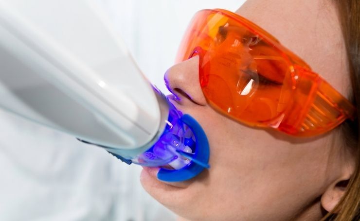 blanqueamiento dental con láser