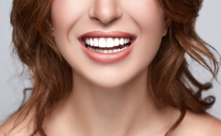 blanqueamiento dental