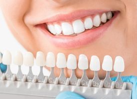 blanqueamiento dental