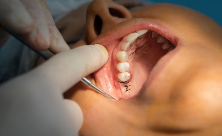 cirujano dentista cirugía maxilofacial