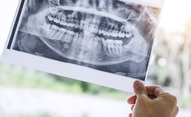 cirugía maxilofacial en CDMX