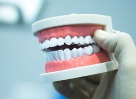 implante dental