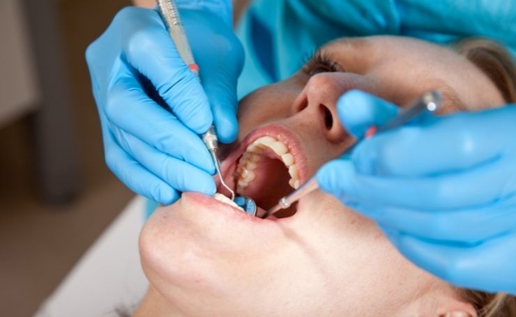 resinas dentales